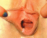 Die Islam-M�nner
                      wollen alles beherrschen, und die Herrschaft �ber
                      das Jungfernh�utchen der jungen Frauen hat nicht
                      absch�tzbare Einschr�nkungen f�r die Frauen zur
                      Folge