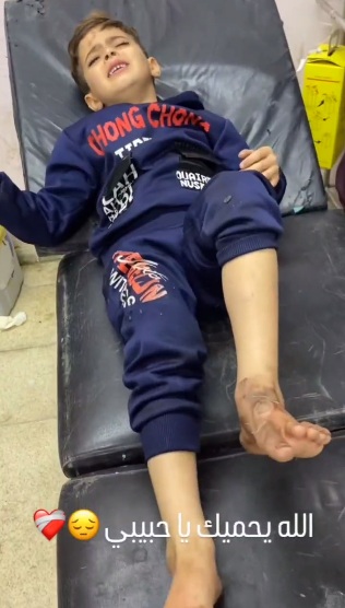 Gaza
                City-KZ 16.11.2023 - 1:08h: Die kriminelle
                Nazi-Zion-Armee hat einen Wohnblock bombardiert - ein
                Kind �berlebte mit einem angebrannten Fuss