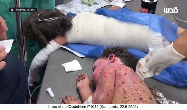 Killer-Israel im Gazastreifen-KZ
                  in Kan Junis am 22.6.2025 - 17:34h: Die
                  Killer-Zion-Armee schiesst auf Zelte der vertriebenen
                  Pal�stinenser - Kind ist halb verbrannt