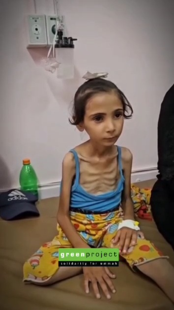 Killer-Israel spielt "Leningrad" am
30.6.2025 - 23:01h: Kinder sind unterernährt nur noch
Haut und Knochen Killer-Israel spielt
"Leningrad" am 30.6.2025 - 23:01h: Kinder
sind unterernährt nur noch Haut und Knochen