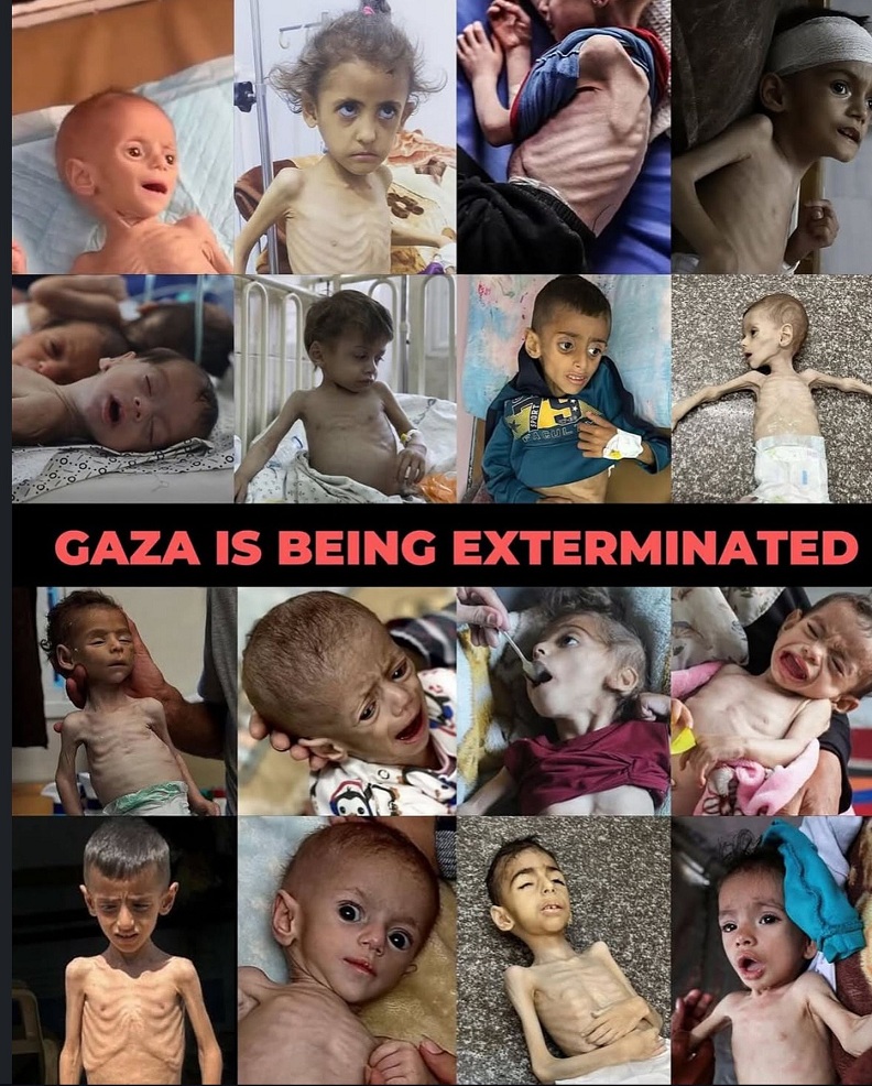 Gazastreifen-KZ am 21.7.2025: 18
palästinensische Kinder sind in den letzten 24 Stunden
verhungert - fast jede Stunde stirbt ein Kind an
Hunger Gazastreifen-KZ am 21.7.2025: 18
palästinensische Kinder sind in den letzten 24 Stunden
verhungert - fast jede Stunde stirbt ein Kind an
Hunger